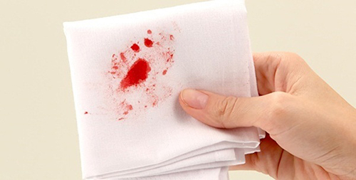 Nguyên nhân đi ngoài ra máu: phòng tránh và cách khắc phục bệnh